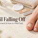 Toenail Falling Off: Causes, Treatment, and How to Heal Fast