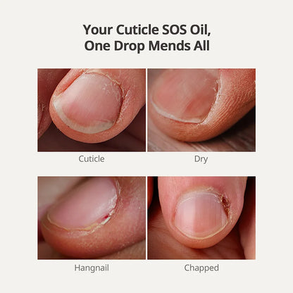 Essential Cuticle Oil