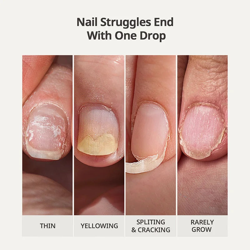 Naillush™ - Nail Strengthener & Growth