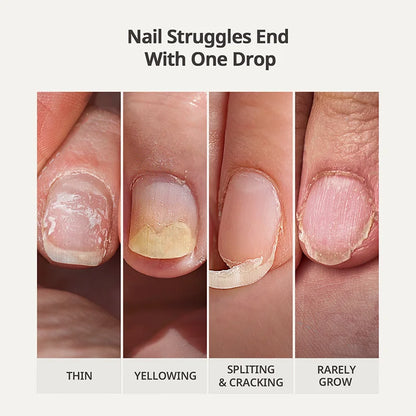 Naillush™ - Nail Strengthener & Growth