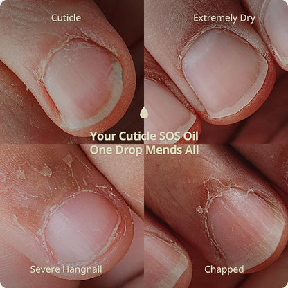 Nutri-Forte Cuticle Oil