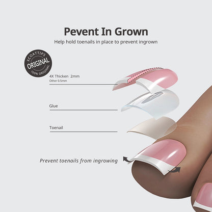 XCOATTIPS® Französisch – Extra Kurze Mandelform